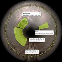 Die „Post-TV-Lösung“ von Pallon